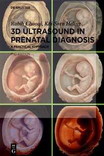 3D Ultrasound in Prenatal Diagnosis (2nd ed.) A Practical Approach