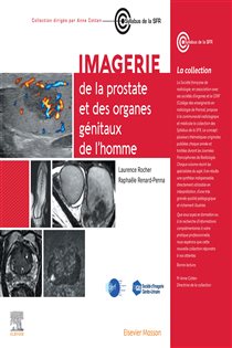 Imagerie du pelvis masculin