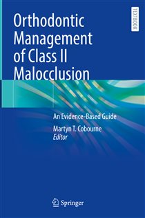 Orthodontic Management of Class II Malocclusion An Evidence-Based Guide