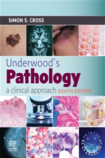 Underwood's Pathology: a Clinical Approach - E-BOOK (8th ed.)