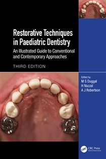Restorative Techniques in Paediatric Dentistry (3rd ed.) An Illustrated Guide to Conventional and Contemporary Approaches