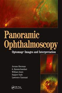 Panoramic Ophthalmoscopy Optomap Images and Interpretation
