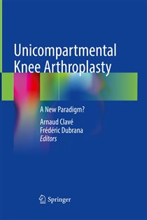 Unicompartmental Knee Arthroplasty A New Paradigm?