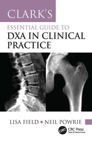 Clark's Essential Guide to DXA in Clinical Practice By Lisa Field, Neil Powrie
