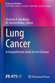 Lung Cancer A Comprehensive Guide for the Clinician