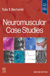 Neuromuscular Case Studies E-Book (2nd ed.)