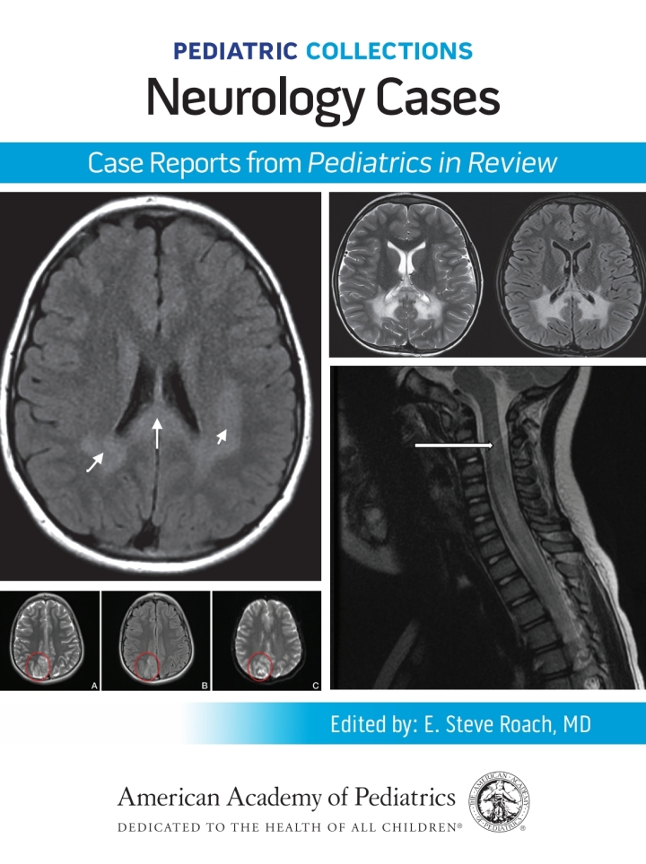 Pediatric Collections: Neurology Cases: Case Reports from Pediatrics in Review