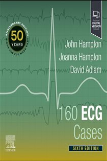 160 ECG Cases (6th ed.)