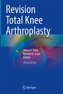 Revision Total Knee Arthroplasty (3rd ed.)