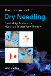 The Concise Book of Dry Needling A Practitioner's Guide to Myofascial Trigger Point Applications