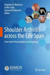 Shoulder Arthritis across the Life Span From Joint Preservation to Arthroplasty