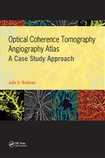 Optical Coherence Tomography Angiography Atlas A Case Study Approach