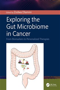 Exploring the Gut Microbiome in Cancer From Biomarkers to Personalized Therapies