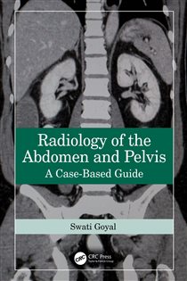 Radiology of the Abdomen and Pelvis A Case-Based Guide