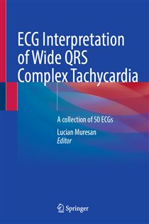 ECG Interpretation of Wide QRS Complex TachycardiaÂ A collection of 50 ECGs