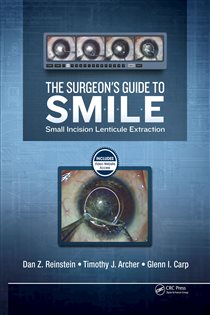 The Surgeon’s Guide to SMILE Small Incision Lenticule Extraction