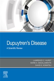 Dupuytren's Disease - E-BOOK A Scientific Review