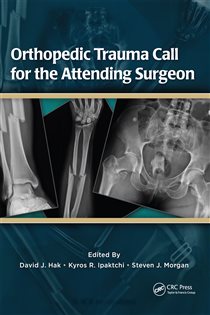 Orthopedic Trauma Call for the Attending Surgeon
