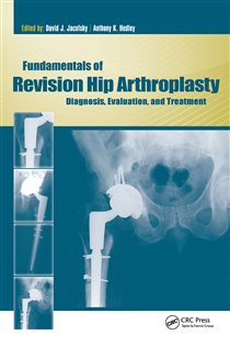 Fundamentals of Revision Hip Arthroplasty Diagnosis, Evaluation, and Treatment