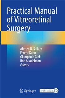 Practical Manual of Vitreoretinal Surgery