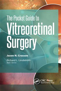 The Pocket Guide to Vitreoretinal Surgery