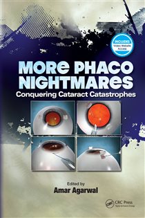 More Phaco Nightmares Conquering Cataract Catastrophesv