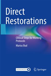 Direct Restorations Clinical Steps for Working Protocols