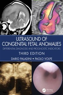 Ultrasound of Congenital Fetal Anomalies (3rd ed.) Differential Diagnosis and Prognostic Indicators