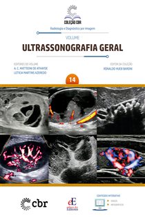 Volume 14 - Ultrassonografia Geral