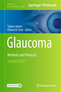 Glaucoma (2nd ed.) Methods and Protocols