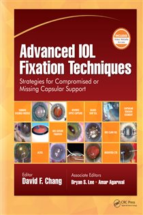 Advanced IOL Fixation Techniques Strategies for Compromised or Missing Capsular Support