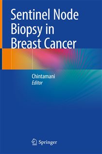 Sentinel Node Biopsy in Breast Cancer