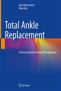 Total Ankle Replacement A Practical Guide to Surgical Management