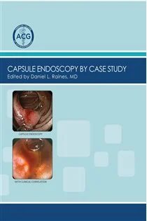 Capsule Endoscopy by Case Study, Volume 2