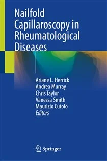 Nailfold Capillaroscopy in Rheumatological Diseases