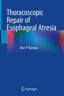 Thoracoscopic Repair of Esophageal Atresia