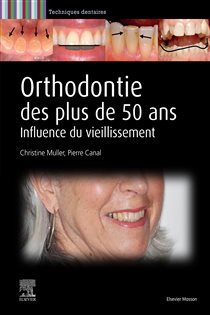 Orthodontie des plus de 50 ans Influence du vieillissement