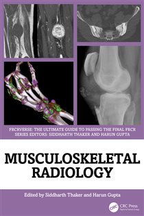 Musculoskeletal Radiology An Ultimate Guide to Passing the Final FRCR