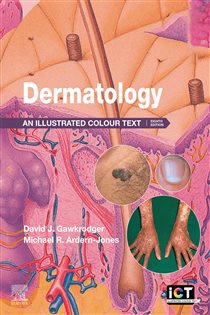 Dermatology - E-BOOK (8th ed.) An Illustrated Colour Text