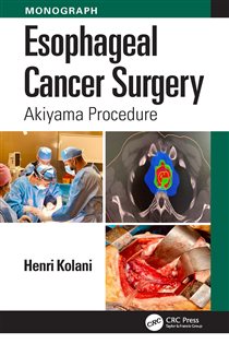 Esophageal Cancer Surgery Akiyama Procedure