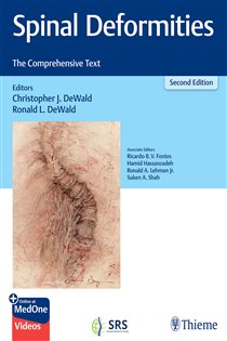Spinal Deformities (2nd ed.) The Comprehensive Text