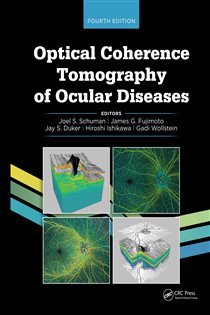 Optical Coherence Tomography of Ocular Diseases (4th ed.)