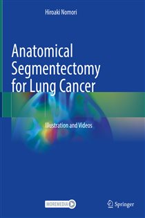 Anatomical Segmentectomy for Lung Cancer Illustration and Videos