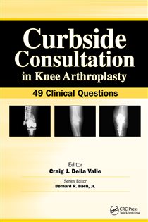 Curbside Consultation in Knee Arthroplasty 49 Clinical Questions