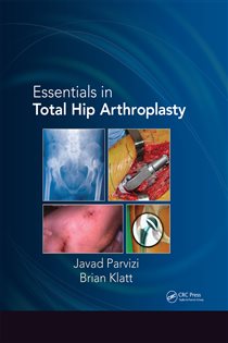 Essentials in Total Hip Arthroplasty