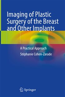 Imaging of Plastic Surgery of the Breast and Other Implants A Practical Approach