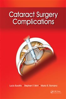 Cataract Surgery Complications