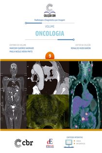 Volume 9 - Oncologia