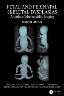 Fetal and Perinatal Skeletal Dysplasias (2nd ed.) An Atlas of Multimodality Imaging