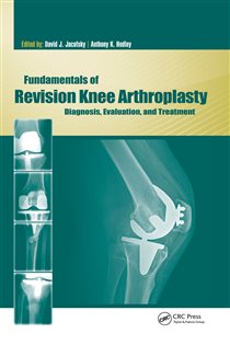Fundamentals of Revision Knee Arthroplasty Diagnosis, Evaluation, and Treatment